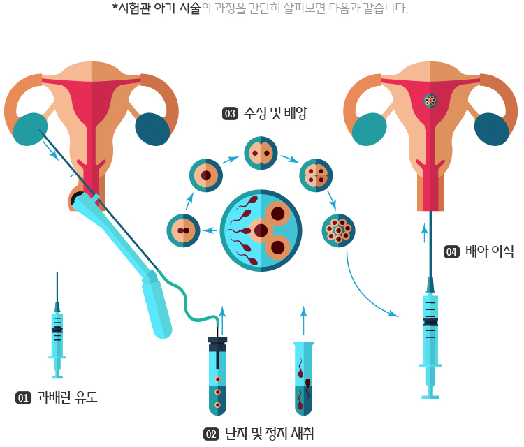 냉동배아이식 / 시험관비용 / 시험관절차 / 5일배양