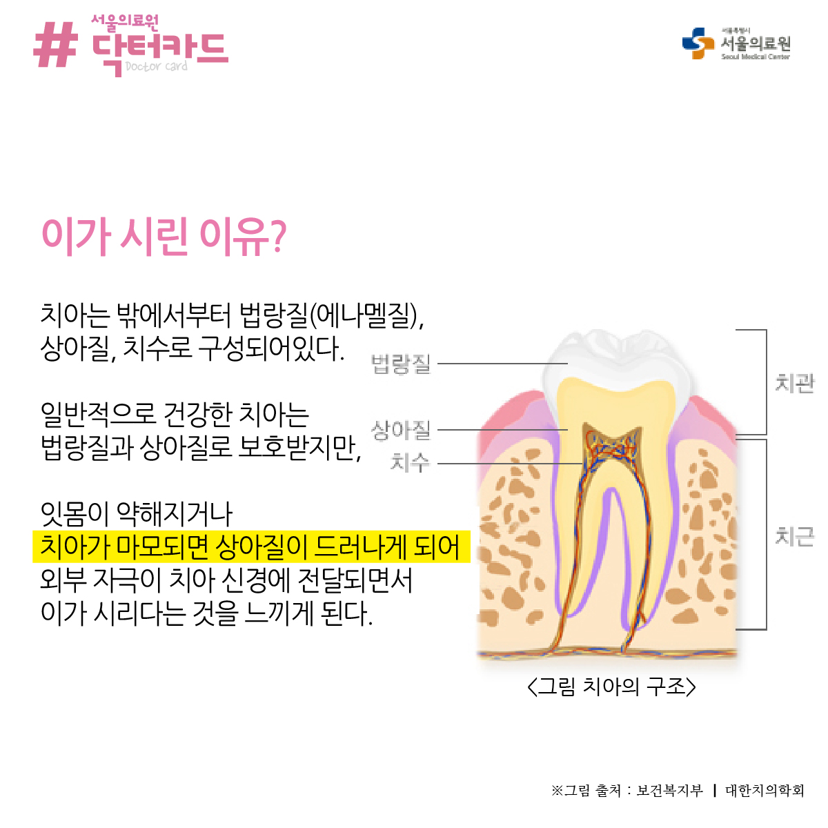이가 시린 이유? 치아는 밖에서부터 법랑질(에나멜질), 상아질, 치수로 구성되어있다. 법랑질. 일반적으로 건강한 치아는 상아질 법랑질과 상아질로 보호받지만, 잇몸이 약해지거나 치아가 마모되면 상아질이 드러나게 되어 외부 자극이 치아 신경에 전달되면서 이가 시리다는 것을 느끼게 된다.
